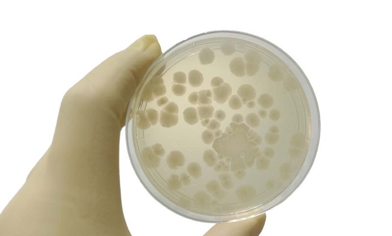 Spore recovery on a culture plate